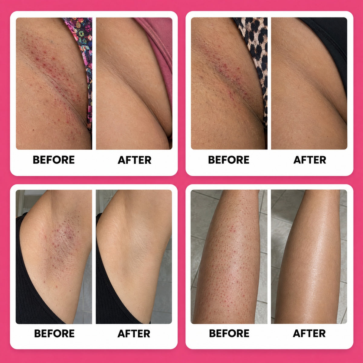 GlowSmooth™ 2-in-1 Body & Face Trimmer
